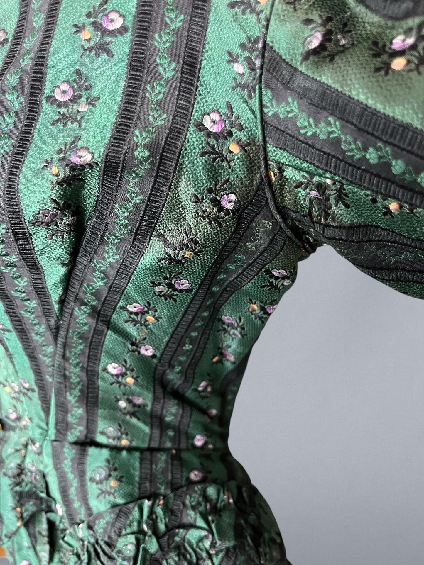 underarm discoloration