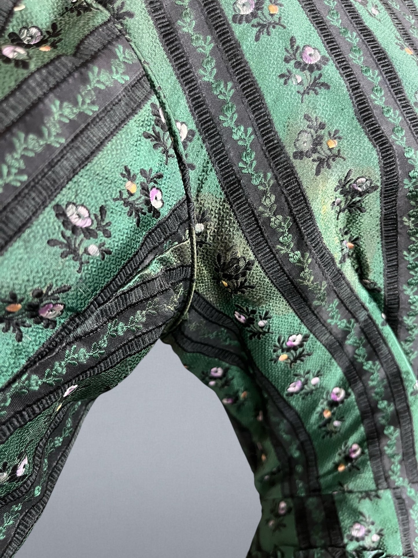 underarm discoloration