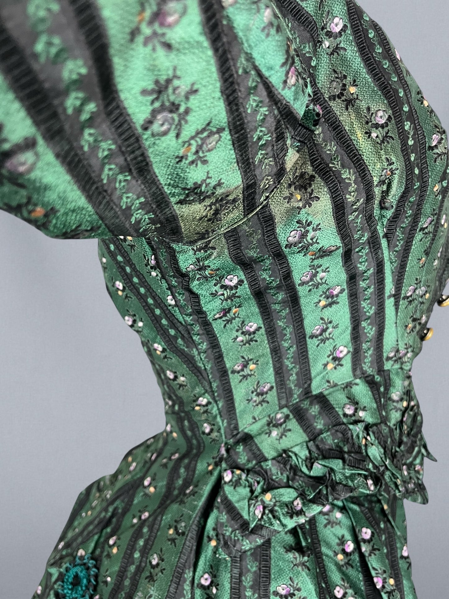 another angle of underarm discoloration